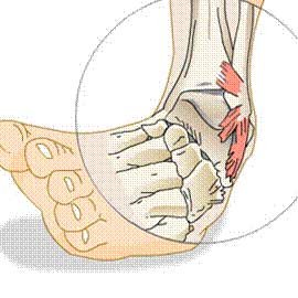 It's Just A Sprain” – The Importance Of Physio For Ankle Sprains