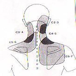 https://www.moveforward.physio/wp-content/uploads/2015/01/non-specific-neck-pain.jpg